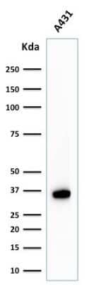 Western Blot: NPM1 Antibody (NPM1/1902) [NBP2-79739]