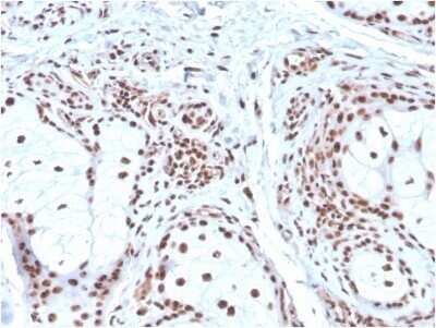 Immunohistochemistry-Paraffin: NPM1 Antibody (NPM1/3286) - Azide and BSA Free [NBP2-79875]
