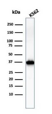 Western Blot: NPM1 Antibody (NPM1/3286) [NBP2-79740]