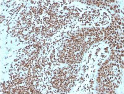 Immunohistochemistry-Paraffin: NPM1 Antibody (NPM1/3287) - Azide and BSA Free [NBP2-79876]
