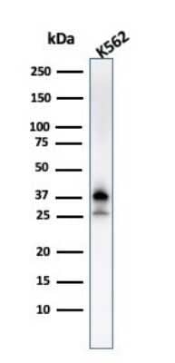 Western Blot: NPM1 Antibody (NPM1/3287) [NBP2-79741]