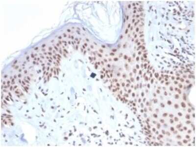 Immunohistochemistry-Paraffin: NPM1 Antibody (NPM1/7072R) [NBP3-13983]