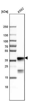 Western Blot: NPM1 Antibody [NBP1-90047]