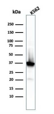 Western Blot: NPM1 Antibody (rNPM1/1901)Azide and BSA Free [NBP3-08750]