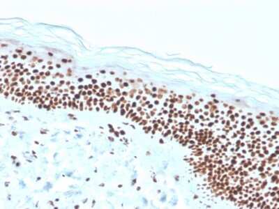 Immunohistochemistry-Paraffin: NPM1 Antibody (rNPM1/1901) [NBP3-07449]