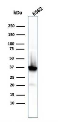 Western Blot: NPM1 Antibody (rNPM1/1901) [NBP3-07449]