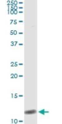 Immunoprecipitation: BNP Antibody (2D11) [H00004879-M01]