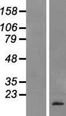 Western Blot: CNP/NPPC Overexpression Lysate [NBP2-06331]