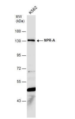 Western Blot: NPRA/NPR1 Antibody [NBP1-32889]