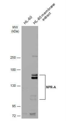 Western Blot: NPRA/NPR1 Antibody [NBP1-31333]