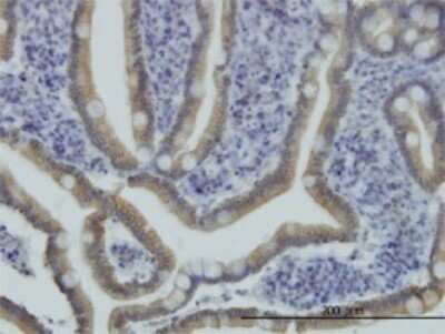Immunohistochemistry-Paraffin: NPRB/NPR2 Antibody (1E4) [H00004882-M02]