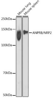 Western Blot: NPRB/NPR2 Antibody (1S1H1) [NBP3-15718]