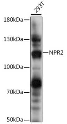 Western Blot: NPRB/NPR2 AntibodyAzide and BSA Free [NBP2-93665]