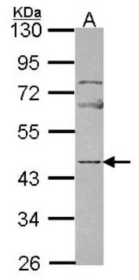 Western Blot: Neuronal Pentraxin 2 Antibody [NBP2-19572]