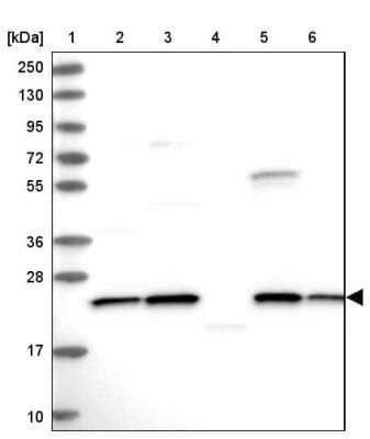 Western Blot: NPVF Antibody [NBP1-86724]