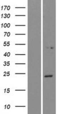 Western Blot: NPVF Overexpression Lysate [NBP2-06457]