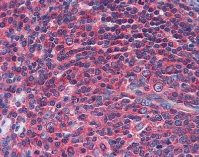 Immunohistochemistry: NPY1R Antibody [NBP1-59008]