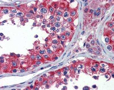 Immunohistochemistry-Paraffin: NPY1R Antibody [NBP1-59008]