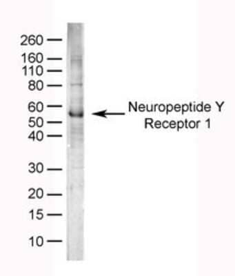 Western Blot: NPY1R Antibody [NB100-65835]