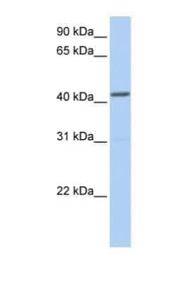 Western Blot: NPY1R Antibody [NBP1-59008]