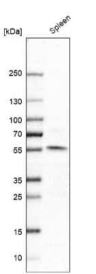 Western Blot: NPY1R Antibody [NBP1-80987]