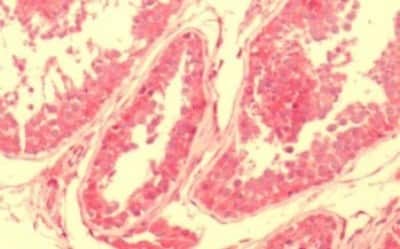 Immunohistochemistry-Paraffin: NPY2R Antibody [NBP3-14425]