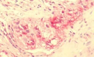 Immunohistochemistry-Paraffin: NPY2R Antibody [NBP3-14425]