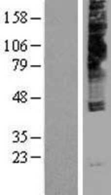 Western Blot: NPY4R Overexpression Lysate [NBP2-10436]