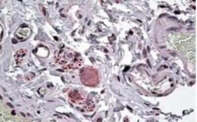 Immunohistochemistry-Paraffin: NPY5R Antibody [NB100-1538]