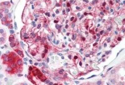 Immunohistochemistry-Paraffin: NQO-1 Antibody (A180) - Azide and BSA Free [NBP2-80885]