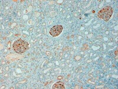 Immunohistochemistry: NQO-1 Antibody [NB100-1005]