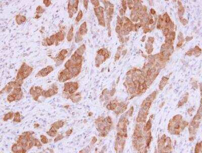 Immunohistochemistry-Paraffin: NQO-1 Antibody [NBP1-31355]
