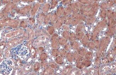 Immunohistochemistry-Paraffin: NQO-1 Antibody [NBP1-31355]