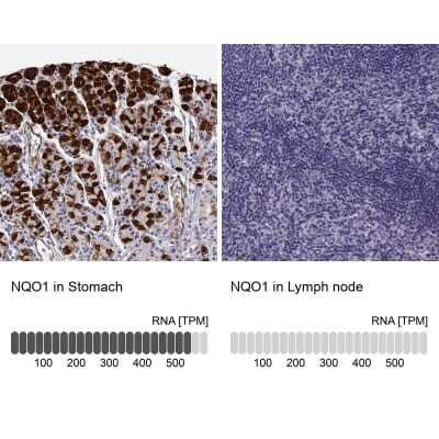 Immunohistochemistry-Paraffin: NQO-1 Antibody [NBP1-85223]