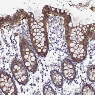 Immunohistochemistry-Paraffin: NQO-1 Antibody [NBP1-85223]