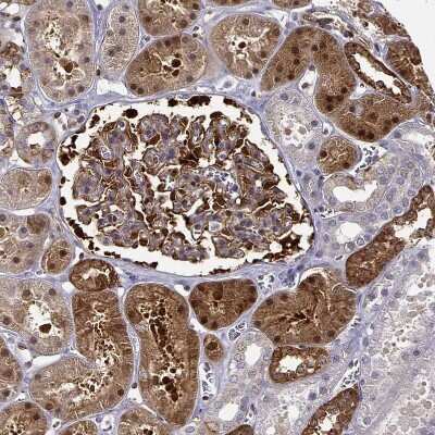 Immunohistochemistry-Paraffin: NQO-1 Antibody [NBP1-85223]