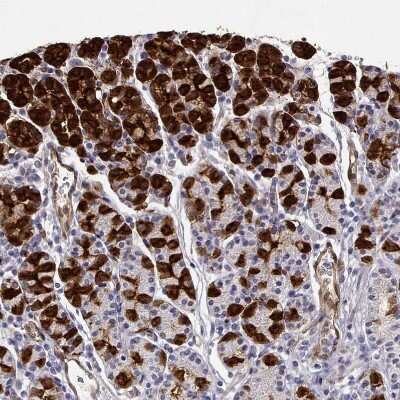 Immunohistochemistry-Paraffin: NQO-1 Antibody [NBP1-85223]