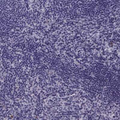 Immunohistochemistry-Paraffin: NQO-1 Antibody [NBP1-85223]
