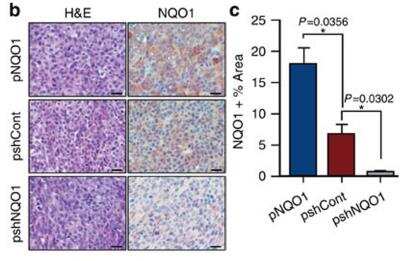 Knockdown Validated: NQO-1 Antibody [NBP1-31355]