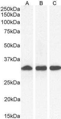Western Blot: NQO-1 Antibody [NB100-1005]