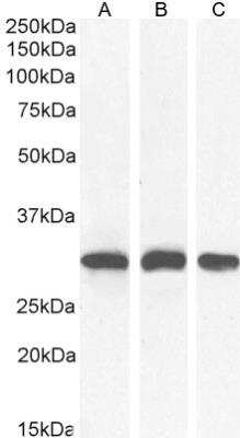Western Blot: NQO-1 Antibody [NB100-1005]