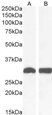 Western Blot: NQO-1 Antibody [NB100-1005]