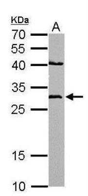 Western Blot: NQO-1 Antibody [NBP1-31355]