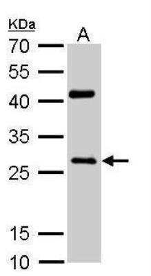 Western Blot: NQO-1 Antibody [NBP1-31355]