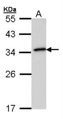 Western Blot: NQO-1 Antibody [NBP2-19573]