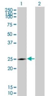 Western Blot: NQO-2 Antibody (3E8-G2) [H00004835-M01]