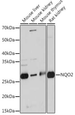 Western Blot: NQO-2 Antibody (5E0B2) [NBP3-16284]