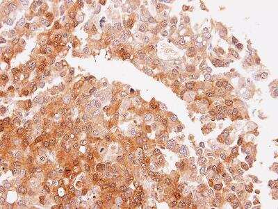 Immunohistochemistry-Paraffin: NQO-2 Antibody [NBP1-31563]
