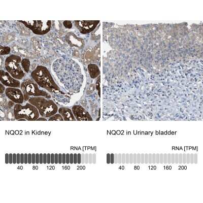 Immunohistochemistry-Paraffin: NQO-2 Antibody [NBP1-85221]