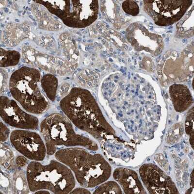 Immunohistochemistry-Paraffin: NQO-2 Antibody [NBP1-85221]